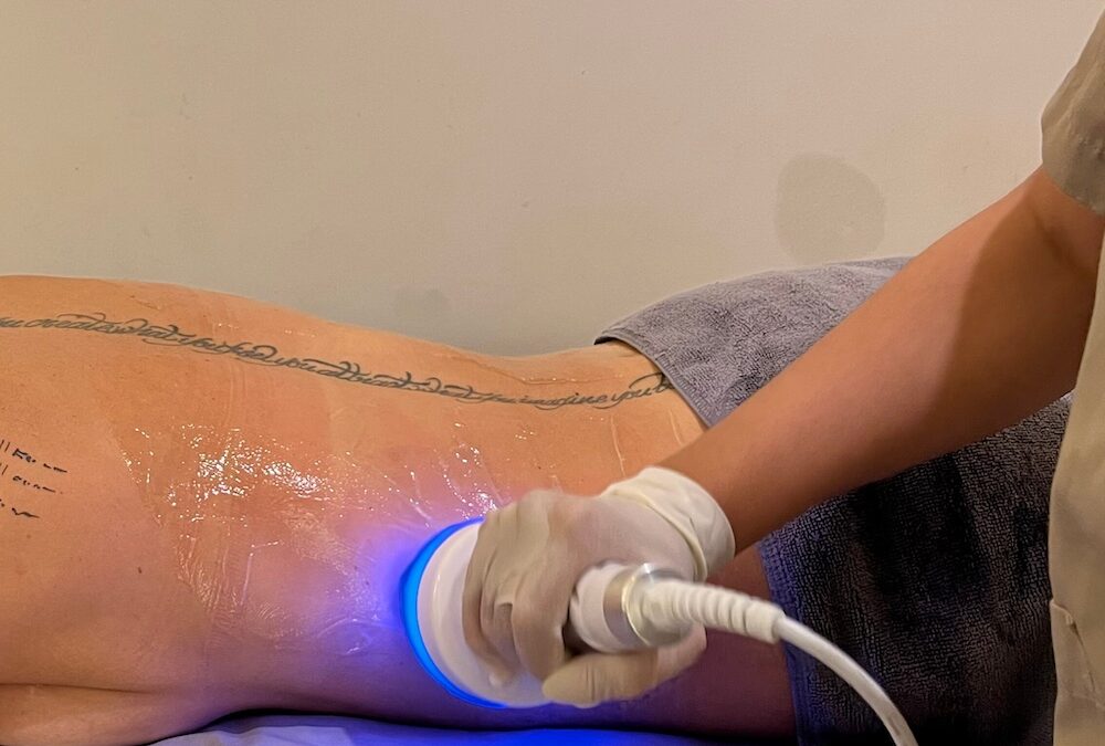 EMSculpt and HIFEM: Building muscle is not removing fat
