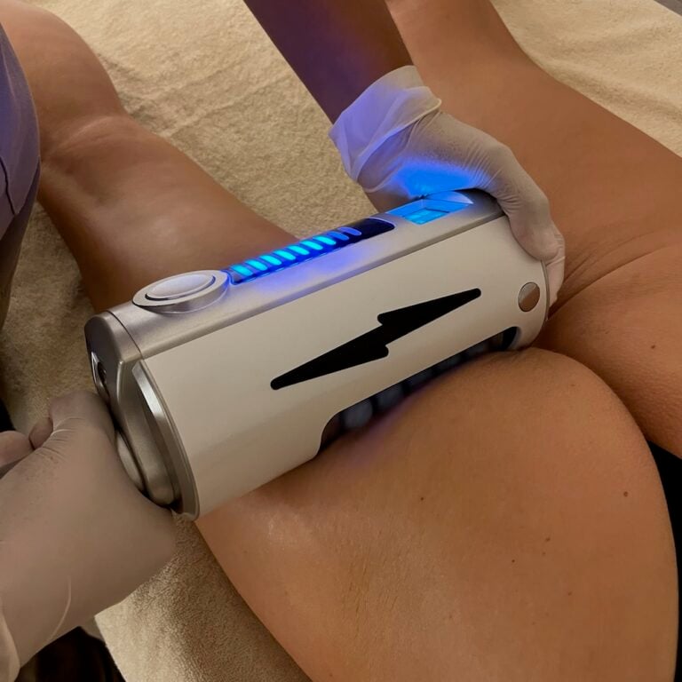 A therapist uses an Endospheres handpiece on a client’s upper thigh and buttock area.