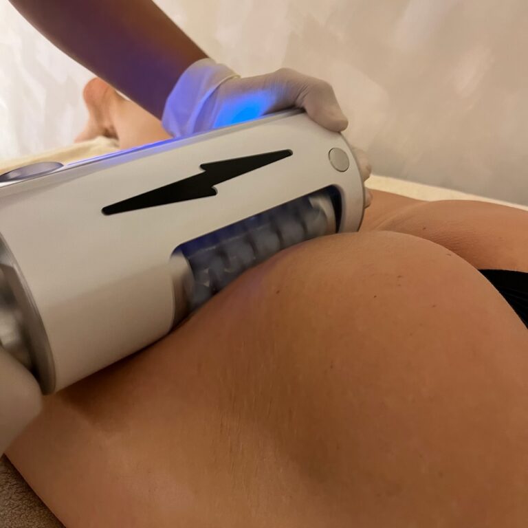 A therapist uses an Endospheres roller handpiece on a client's thigh.
