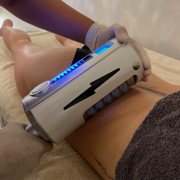 A therapist applies an Endospheres roller handpiece to a client’s thigh.