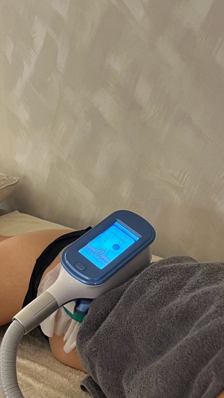 A cryolipolysis applicator is clamped to a client's abdomen during a body treatment.