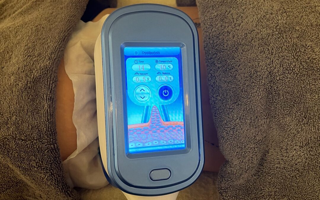 Reading fat freezing before-and-after photos without being fooled