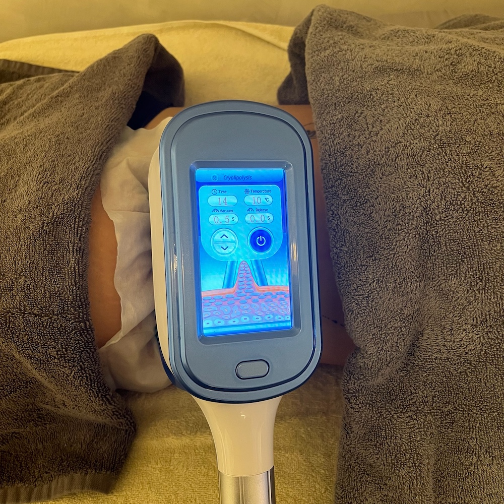 Cryolipolysis fat freezing machine