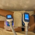 Two cryolipolysis cooling applicators placed on a client's body during a fat freezing session at Body Studio Bali.