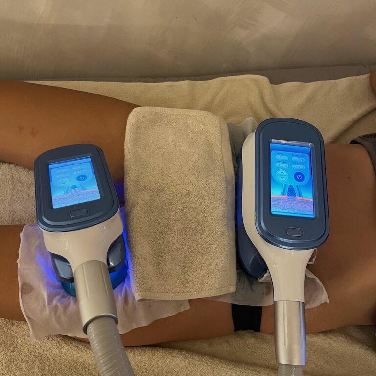 CoolSculpting fat freezing treatment room at Body Studio Bali Uluwatu