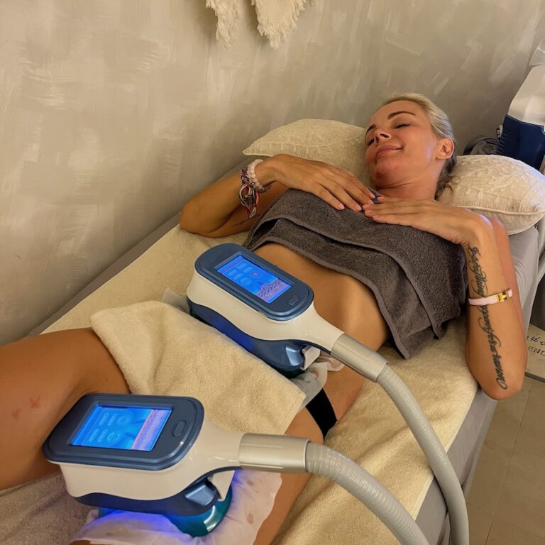 A client receives cryolipolysis treatment with clamped applicators on the abdomen and thigh.