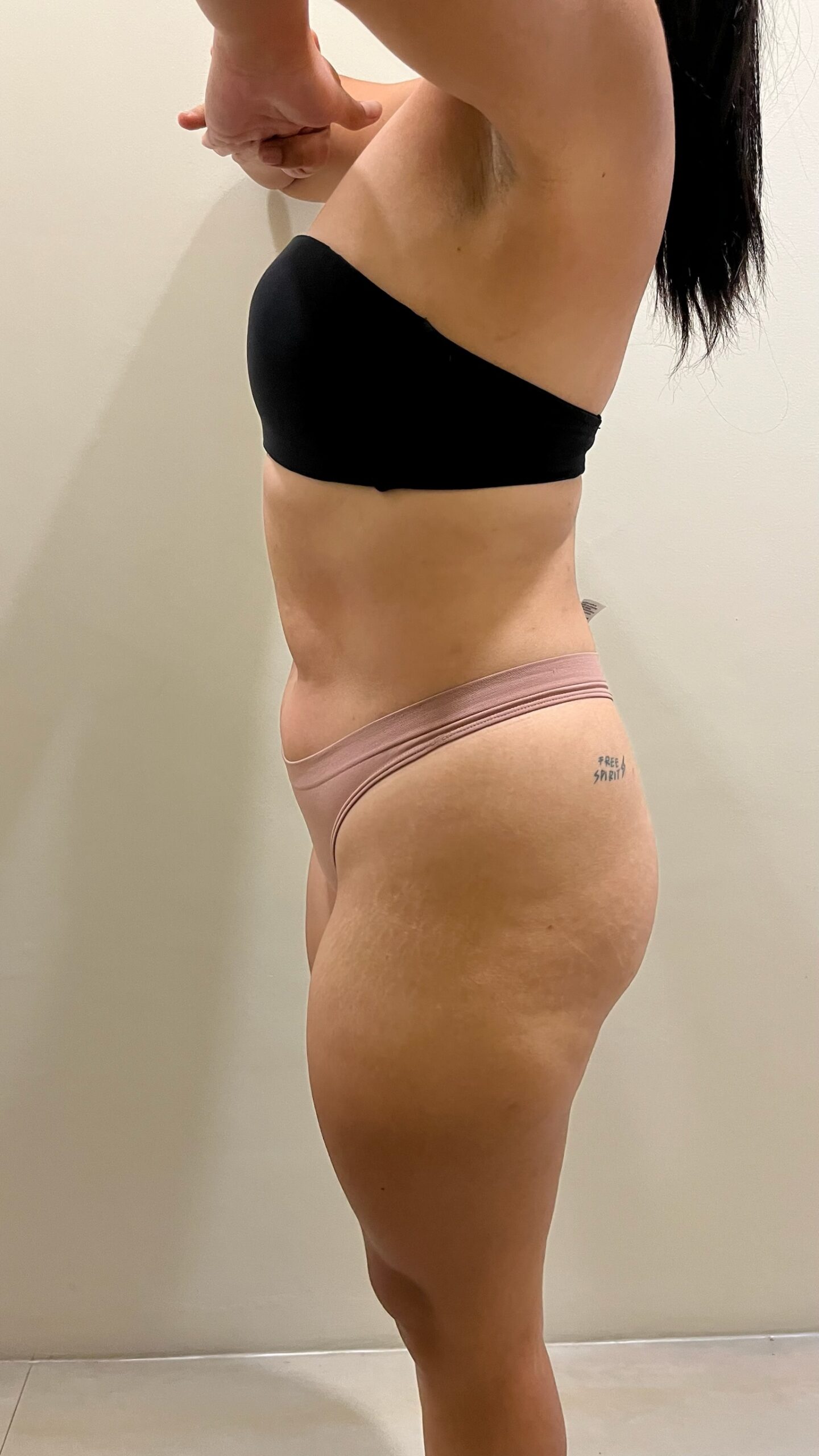 After treatment result 1