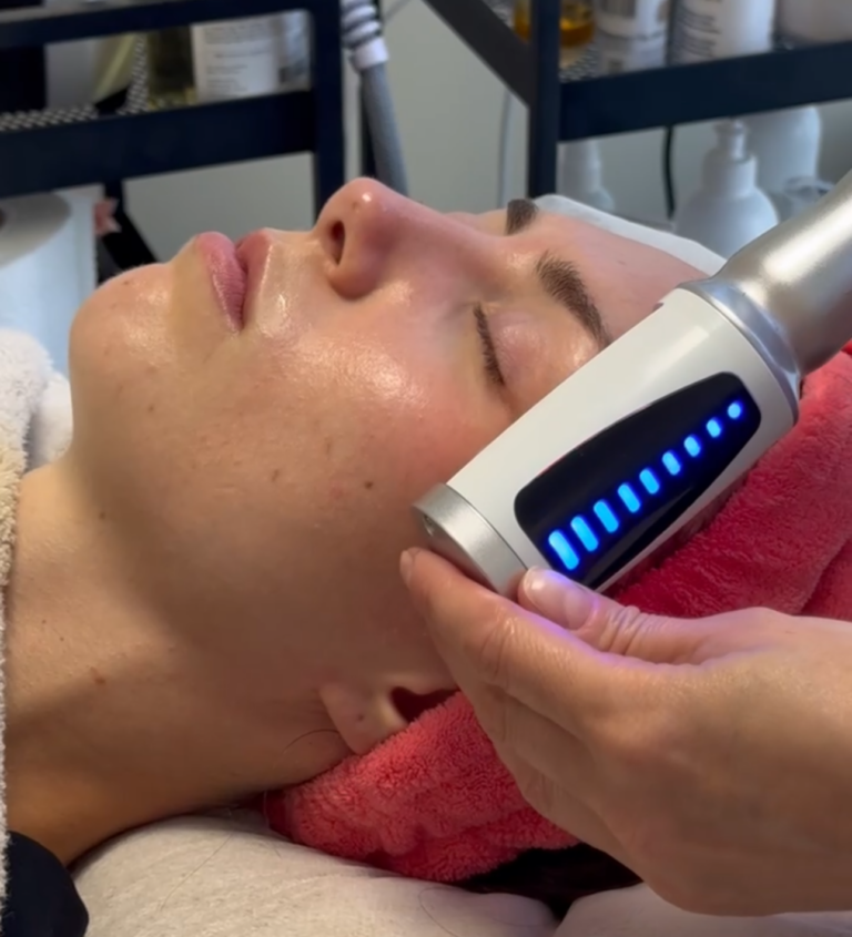 A therapist applies a handheld radiofrequency probe along a client's jawline.