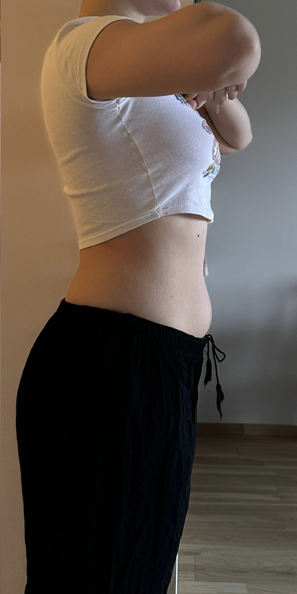 After treatment result 4