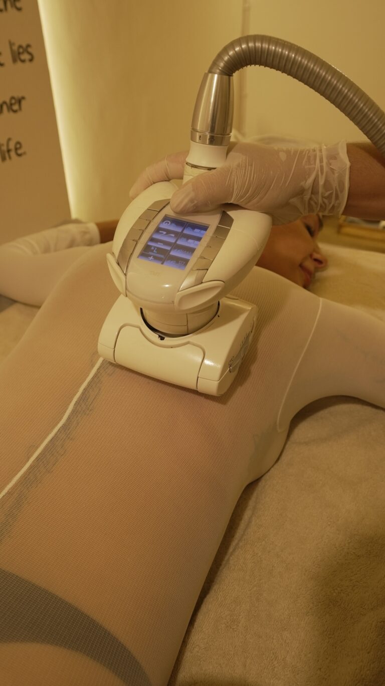 흰색 관리복을 입은 고객에게 LPG Endermologie 관리를 진행하는 테라피스트.